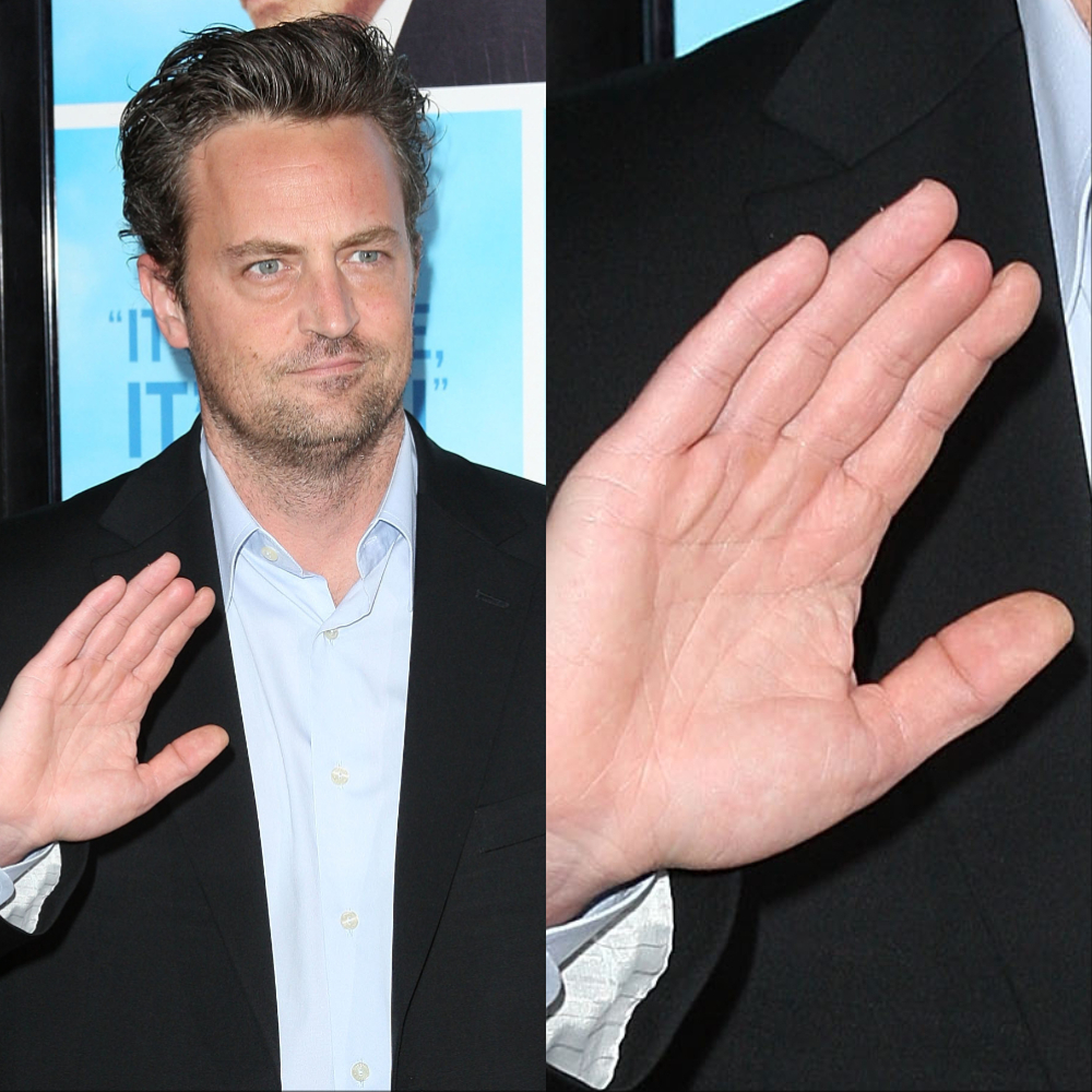 Celebs with ugly hands