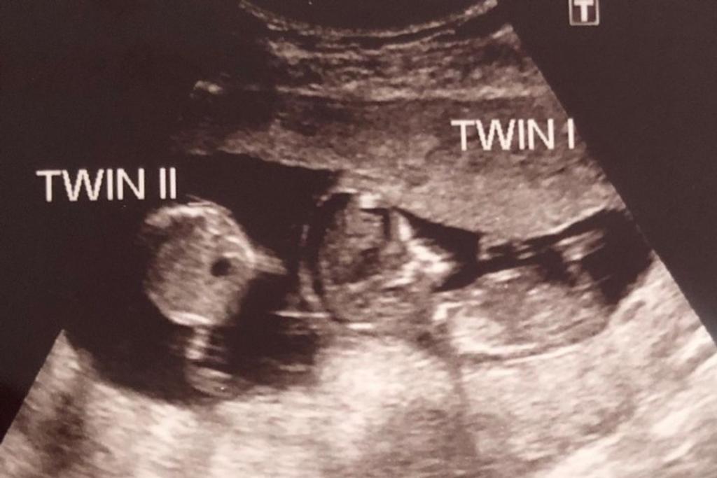 Rebecca Roberts, Twins, Pregnancy