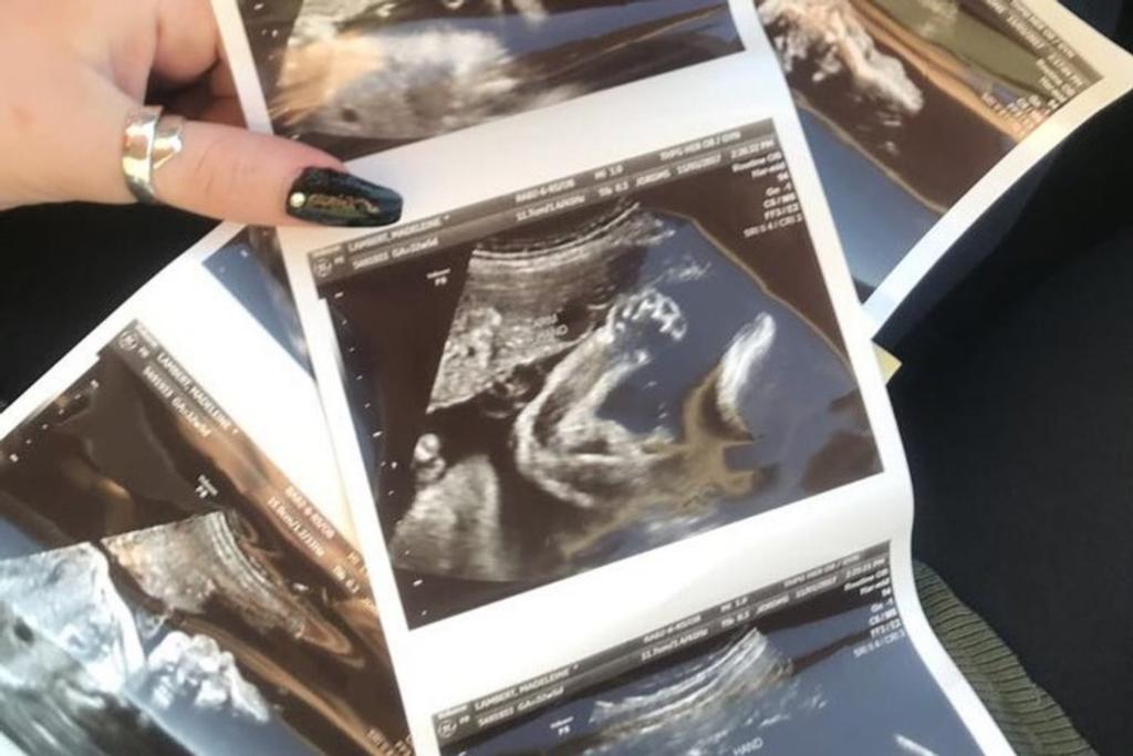 Pregnancy Confirmed Maddie Lambert