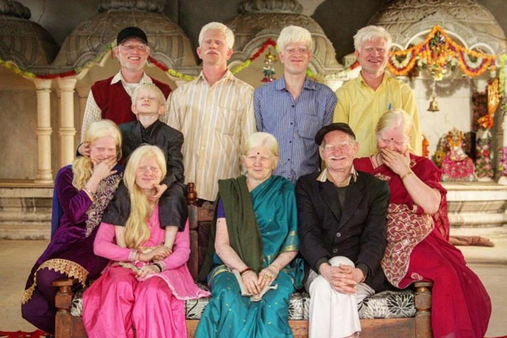 Albino Family Dominant gene