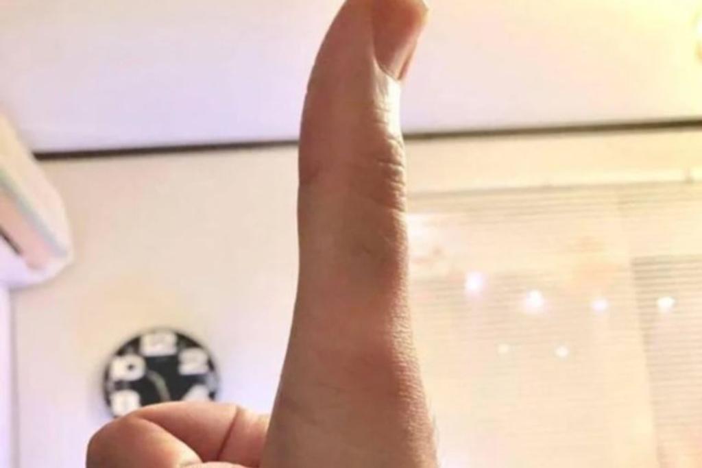 extra long thumb finger