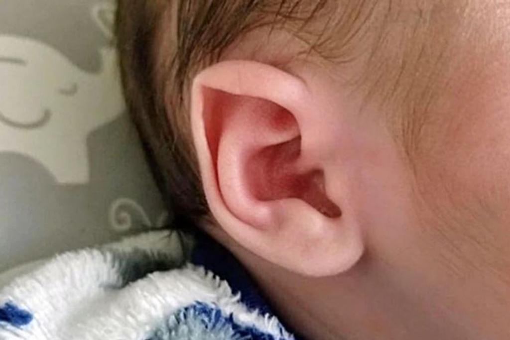 baby elf pointed ears