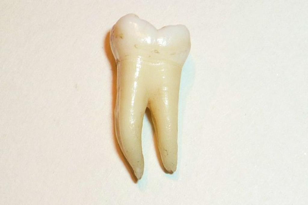 John Lennon Tooth Memorabilia 