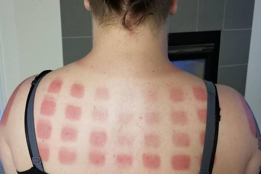 Worst Sunscreen Tan Lines