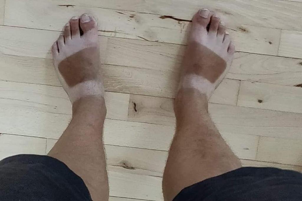 Worst Sunburn Fails Sandals